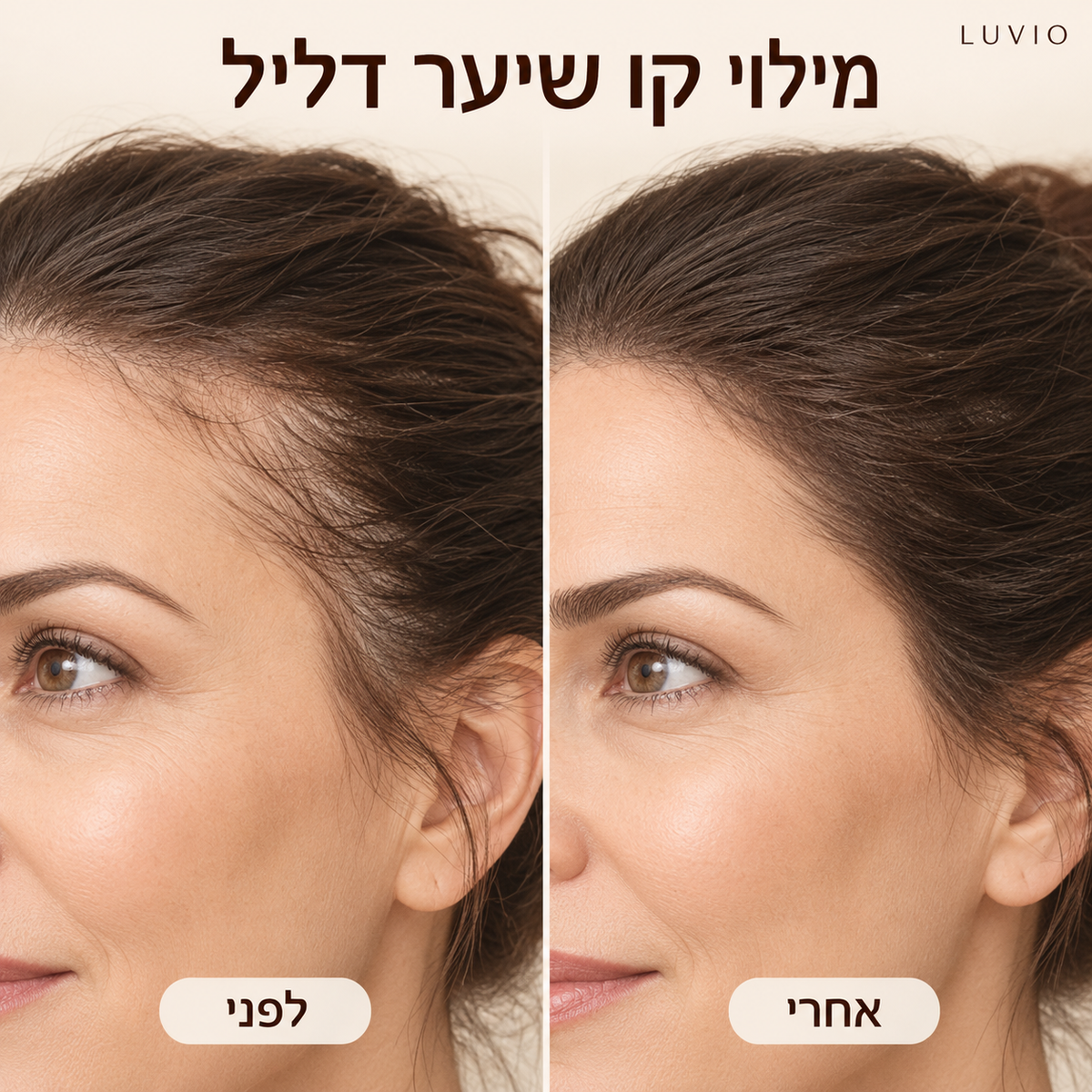 HairFill™ | מראה שיער מלא ושופע תוך שניות