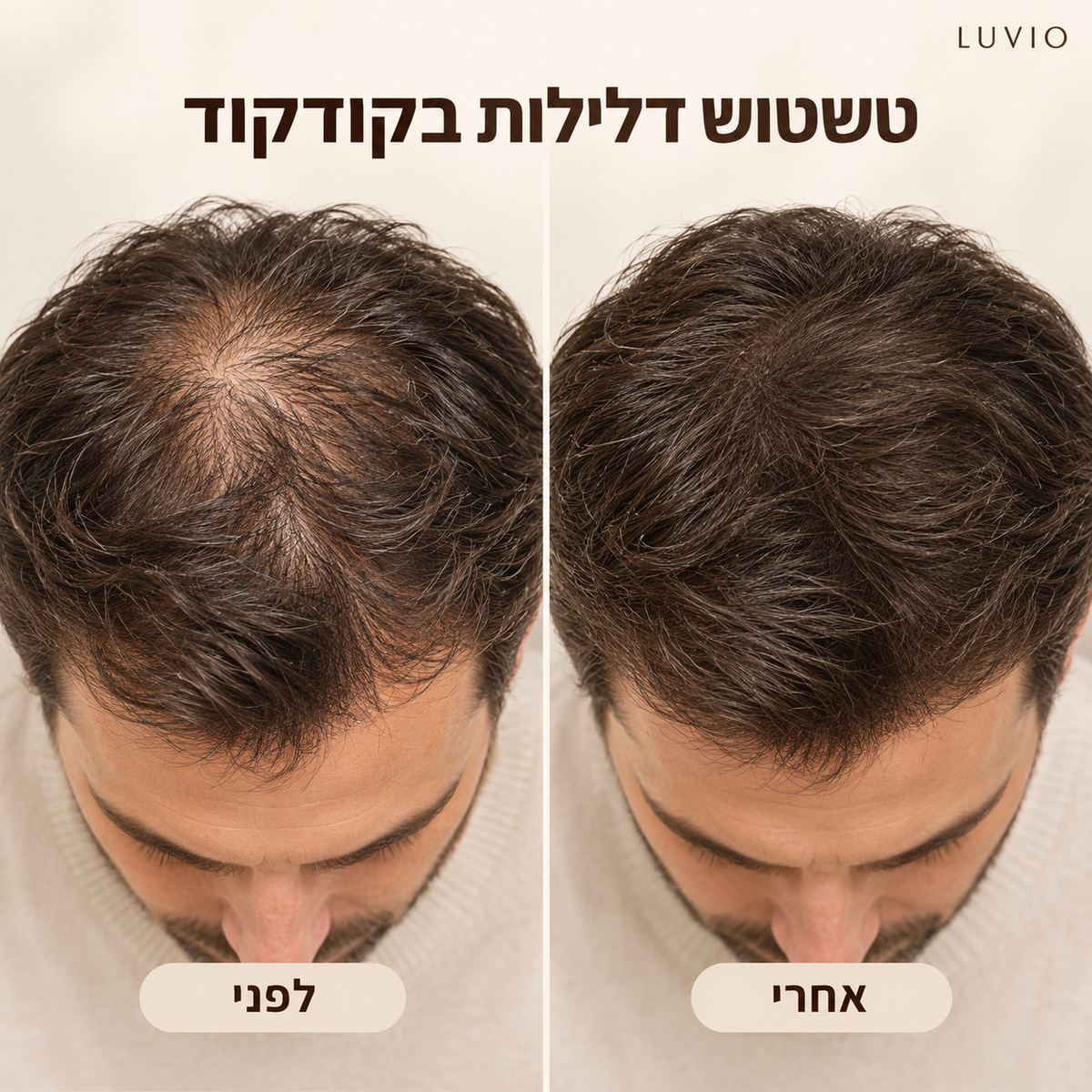 HairFill™ | מראה שיער מלא ושופע תוך שניות