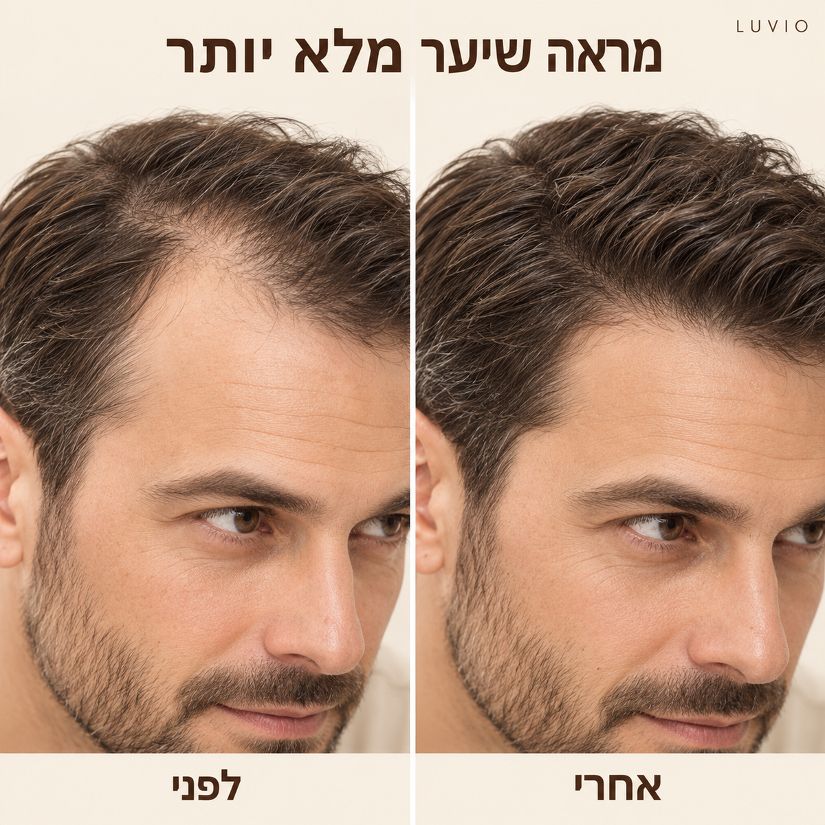 HairFill™ | מראה שיער מלא ושופע תוך שניות